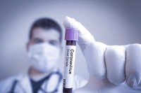 U FBiH preminulo šestoro zaraženih koronom, 174 novooboljelih