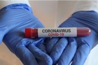 FBiH: 191 novi slučaj virusa korona, 11 smrtnih slučajeva