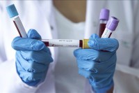 У ФБиХ заражено још 379 особа