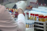 Студија о серолошким испитивањима на територији Српске почиње 1. новембра