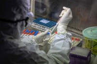 Zeljković: Urađeno više od 100.000 testiranja