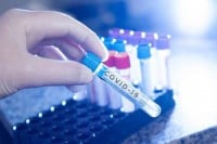 Kompenzacioni fond: Za nabavku 90.000 PCR testova 3,7 miliona KM