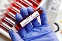 U FBiH više od 1.100 zaraženih, preminulo 21 lice