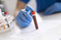 Почела серолошка тестирања у Српској: Првих 100 узорака спремно за анализу