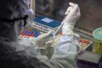 U Republici Srpskoj 22 smrtna slučaja, oboljele još 282 osobe