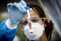 У Српској још 18 особа преминуло од короне, 125 новозаражено