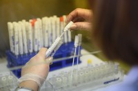 У Српској 180 новообољелих, преминуле 22 особе
