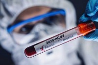 U FBiH preminulo 11 lica, još 304 novozaraženih
