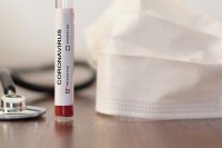 Два турчина и Рус покушали да уђу у БиХ са фалсификованим PCR тестовима