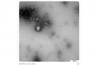 Rusi napravili prvu fotografiju novog soja korone