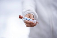 Вирусом корона заражено још 125, умрло пет људи