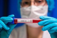 U Srpskoj virus korona potvrđen kod 134 osobe, osam preminulih