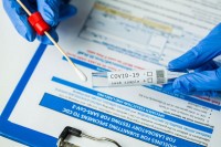 У Српској 27 случајева вируса корона, четворо преминулих