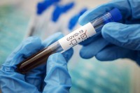 Čerkez: Povećan broj zaraženih zbog nepridržavanja mjera