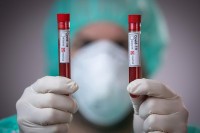 У ФБиХ преминуле 22 особе, више од 500 заражених