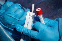 У Српској 283 новообољелих, умрло 18 људи
