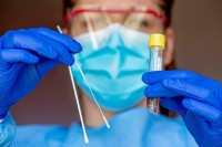 Mađarska donirala Srpskoj 19.488 PCR testova