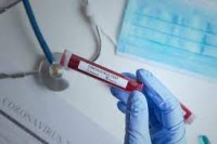 U FBiH preminulo 58 lica, zaraženo još 1.549