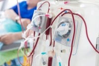 Апел да бубрежни болесници буду међу приоритетнима за вакцинацију