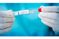 Умрле 33 особе, вирусом корона заражене још 442