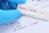 Đaci falsifikovali pozitivne rezultate testova na koronu da ne idu u školu