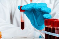 СЗО дао зелено свјетло за другу фазу студије: Наставак серолошког тестирања 10. маја