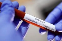 Koronom zaraženo još 263 ljudi, umrlo 12