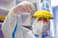 FBiH: Trideset preminulih, 389 pozitivnih na virus korona