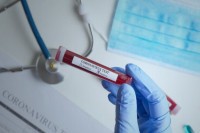 FBiH: Šest lica preminulo, zaraženo još 75