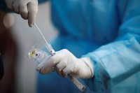 Вирус корона потврђен код још шест људи, једна особа преминула