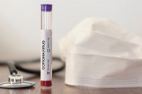 Nema preminulih, ni zaraženih virusom korona u Srpskoj