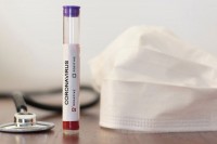 Virusom korona u Srpskoj zaraženo 14 lica, nema preminulih