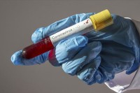 Turčin pozitivan 14 mjeseci na virus korona