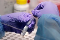 Virus korona potvrđen kod još 13 osoba u Srpskoj, preminuo stariji muškarac