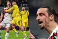 Žestok sudar glavama Ibrahimovića i Medela: Zlatanu potekla krv, ali je Čileanac izašao iz igre