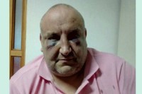 Muškarac iz Viteza, osumnjičen za premlaćivanje poznanika zbog duga za drogu, pušten na slobodu