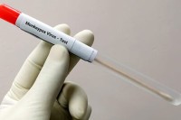Razvijen PCR test za majmunske boginje