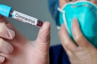 U Srpskoj zaraženo još 12 lica, preminuo muškarac iz Dervente