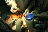 Srbija jedina zemlja poslije SAD gdje je obavljena transplantacija jajnika