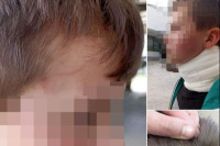 Žena koja je pretukla dijete u osnovnoj školi u Sarajevu osumnjičena za nasilničko ponašanje