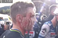 Pogledajte žestok sudar bicikliste i žene u publici na Vuelti, Belgijanac izvukao deblji kraj