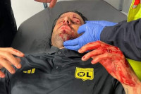 Detalji napada u Marseju: Majmunski urlici i nacistički pozdravi (FOTO/VIDEO)