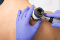 Sutra Svjetski dan borbe protiv melanoma