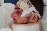 Danijel Petrović za "Glas" ispričao ko ga je napao: Život mi je ugrožen!