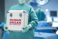 Transplantacija još uvijek samo san za oboljele u Srpskoj