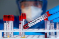 Hospitalizovanima od kovida smanjen IQ za 10
