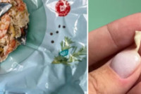 Postala vegetarijanka nakon što je našla zub u hrani