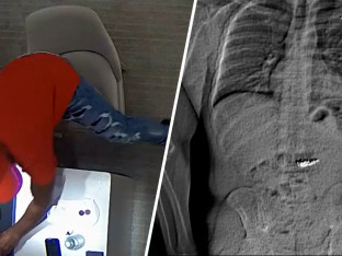 Kradljivac progutao minđuše vrijedne 770 hiljada dolara