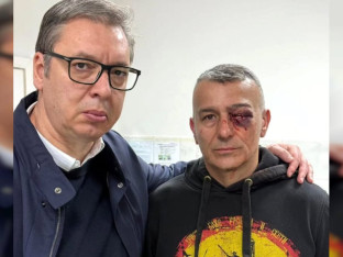 Lončar: Ljekari se bore da spasu oko i vid žandarmu