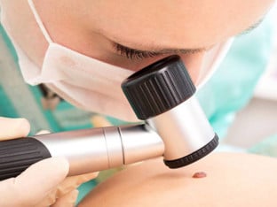 Prevencija raka kože: Besplatni pregledi